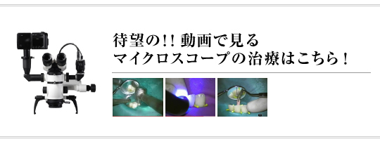 microScope 動画で見るマイクロスコープの治療