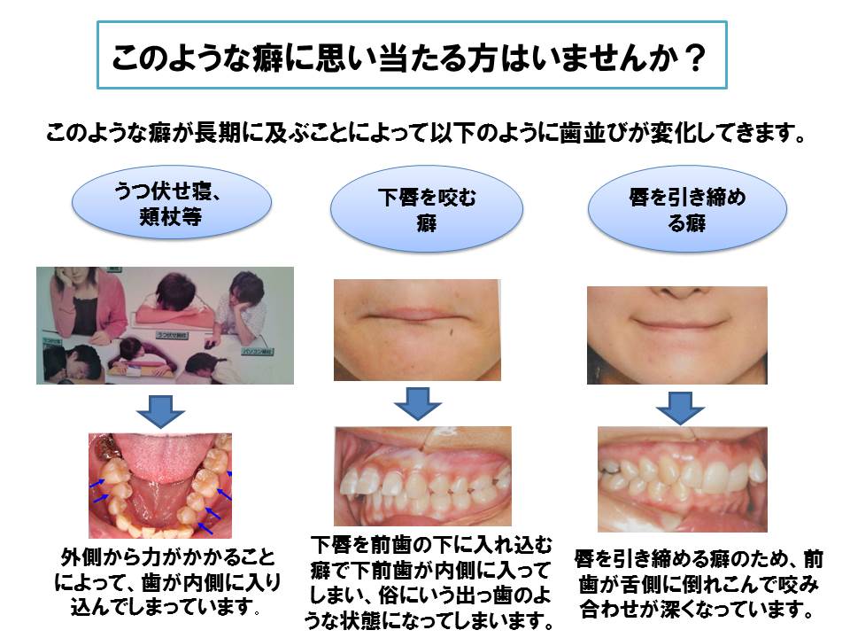 態癖 : 力のコントロール - 本