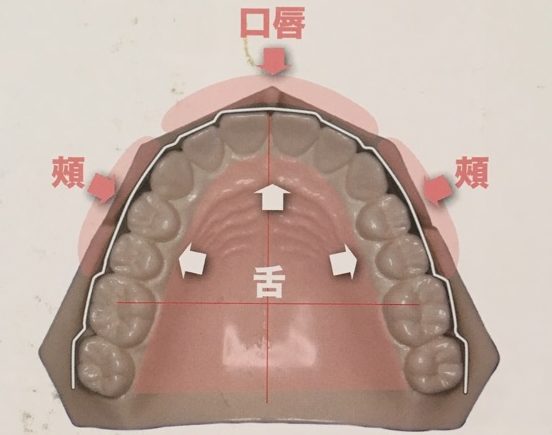 歯の並び方の写真
