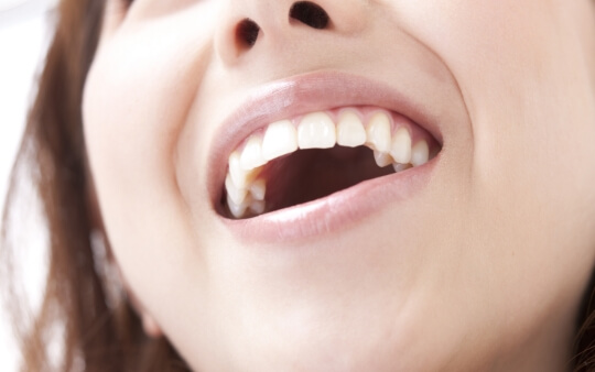 健康な口腔内で過ごす為のバクテリアセラピー